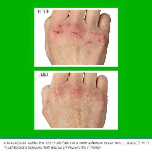 OKeeffes Working Hands hidratáló kézkrém száraz, repedezett bőrre tégelyes 96g