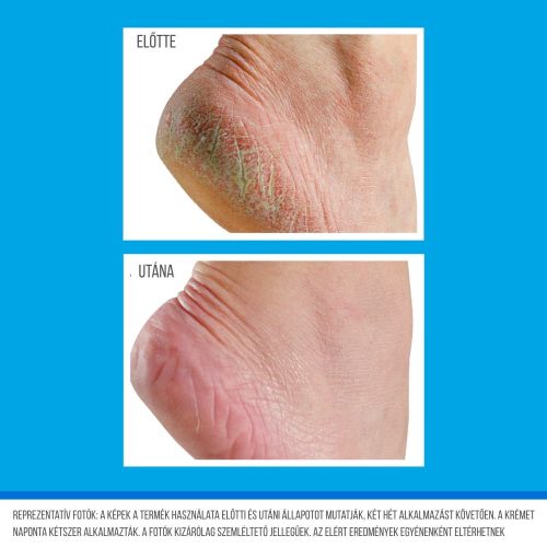 OKeeffes Healthy Feet Exfoliating hámlasztó és hidratáló lábkrém – tubusos, 80 ml